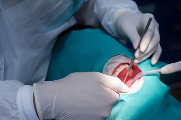 The Different Approaches To Oral Surgery